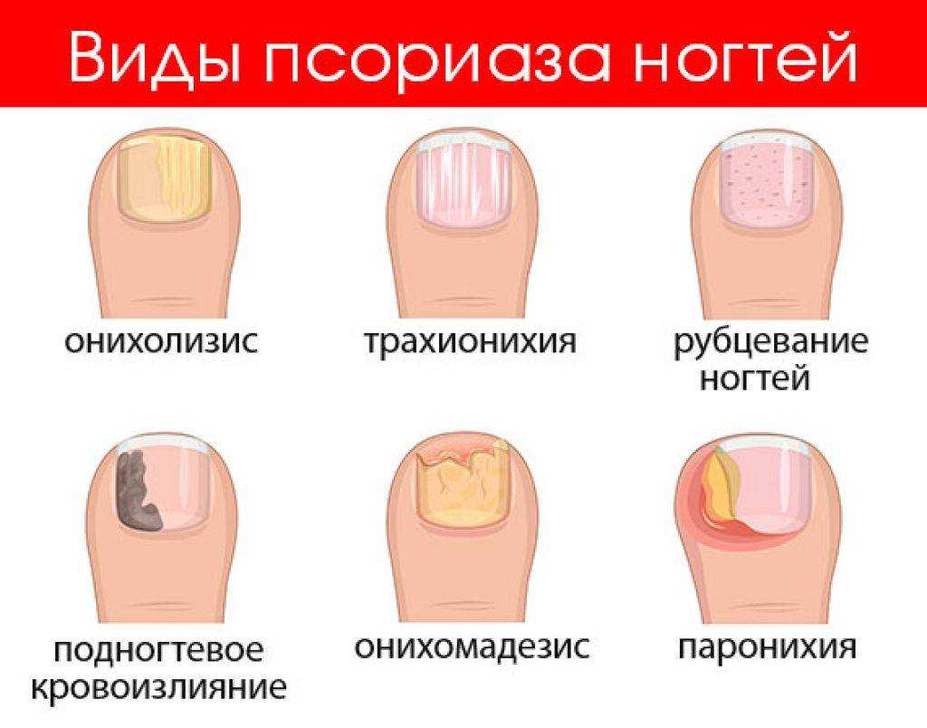 Зачем мужчины отращивают ноготь на мизинце: значение