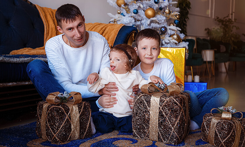 Редкий синдром тричера коллинза. когда лена родила ребенка, врачи не хотели ей его показывать | правмир